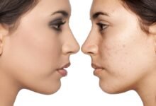 Makeup vs. Skincare